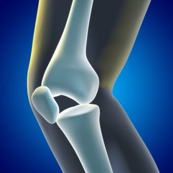A Medical illustration of a knee xray showing knee and bones