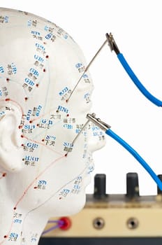 Electro-Acupuncture