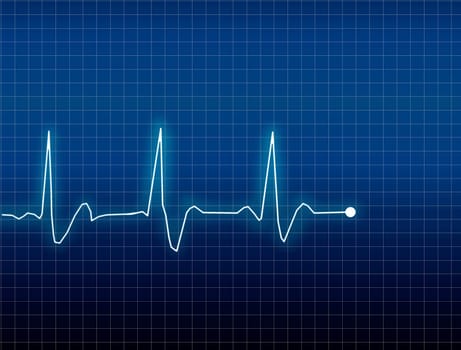 ECG Electrocardiogram