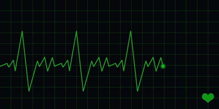 electrocardiogram ecg.