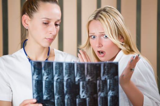 two women doctors reading MRI film scans of patient&#039 s spine - shocked diagnosis scene.