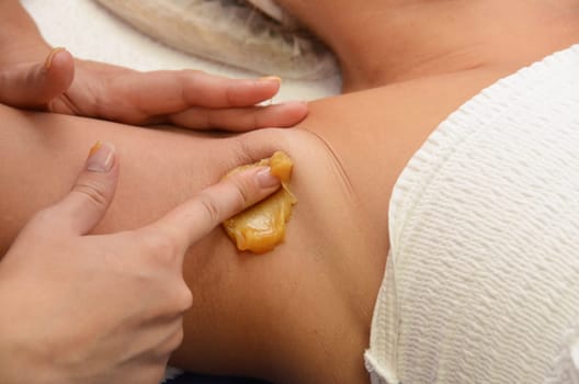 Sugaring: epilation with liquate sugar at armpit.