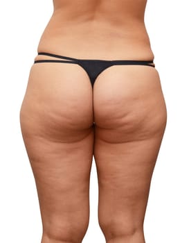Closeup of cellulite skin at woman buttocks on a white