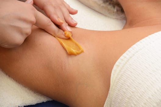Sugaring: epilation with liquate sugar at armpit.