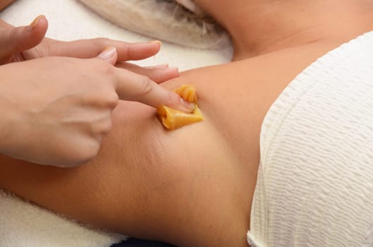 Sugaring: epilation with liquate sugar at armpit.
