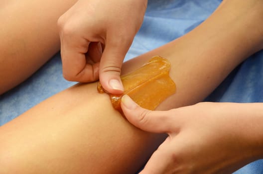 Sugaring: epilation with liquate sugar at legs.