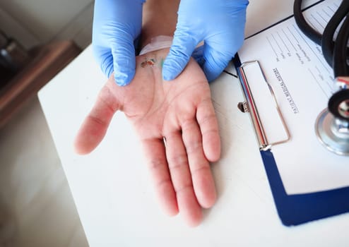 The doctor examines the healing wound of the patient on the hand palm scarring healing