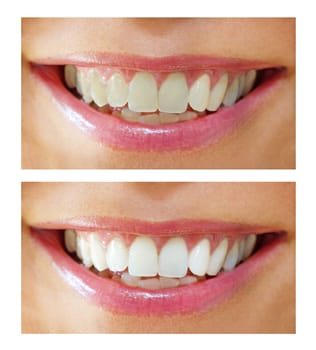 Bleaching effect - before and after