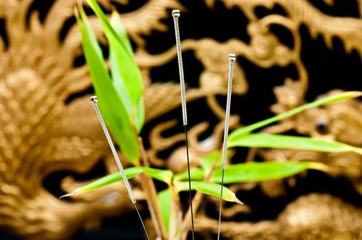Acupuncture needles