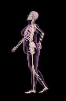 3D render of an overweight female medical skeleton with back pain