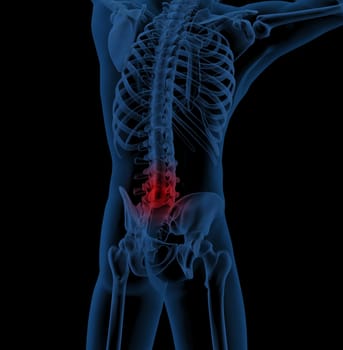 3D render of a medical skeleton illustrating back pain