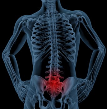 3D render of a skeleton highlighting pain in the back