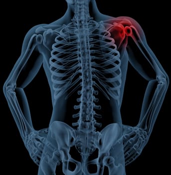 3D render of a medical skeleton with the shoulder joint highlighted