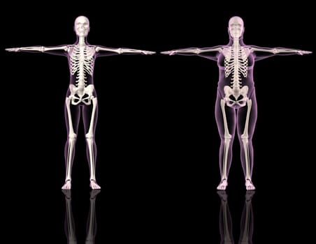 3D renders of two female skeletons one slim and one overweight
