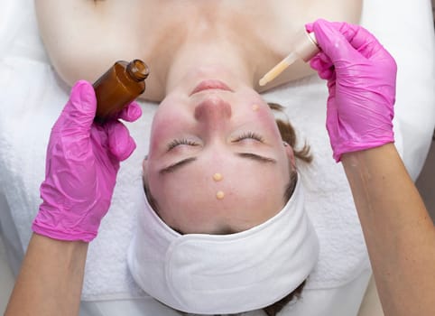 Beautician Applies Serum To Woman's Face With Pipette After Peeling Beauty Procedure In Spa Salon. Facial Skin Care With Treatment Cosmetic Oil, Serum. Young Girl Enjoys Skin Moisturizing Procedure