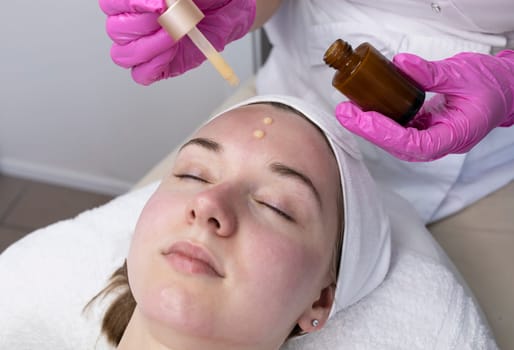 Aesthetician Applying Serum To Patient's Face With Pipette After Peeling Beauty Procedure In Spa Salon. Facial Skin Care With Treatment Cosmetic Oil, Serum. Woman Enjoys Skin Moisturizing Procedure.