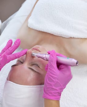 Closeup Aesthetician Making Mesotherapy Injection With Dermapen On Face, Nose Area Of Young Woman For Rejuvenation In Spa Center. Patient Getting Needle Mesotherapy, Skincare. Vertical Plane.
