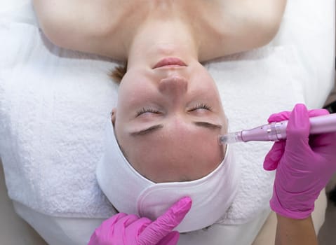 Top View Patient Getting Needle Mesotherapy, Skincare. Aesthetician Making Mesotherapy Injection With Dermapen On Face, Forehead Area Of Young Woman For Rejuvenation In Spa Center. Horizontal Plane.