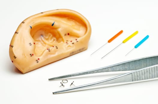 Ear Acupuncture