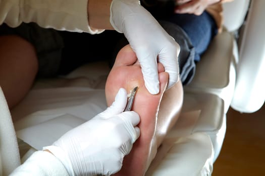 Medical Foot Care - Foot care - Chiropody