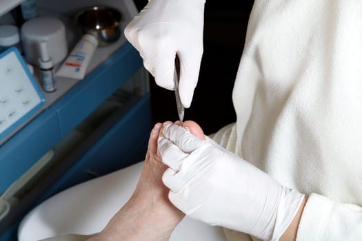 Medical Foot Care - Foot care - Chiropody