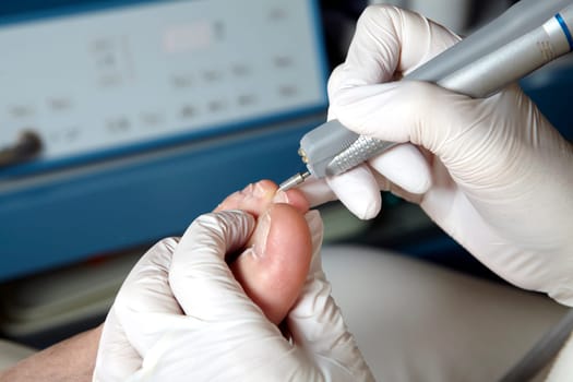 Medical Foot Care - Foot care - Chiropody