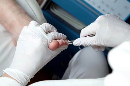 Medical Foot Care - Foot care - Chiropody