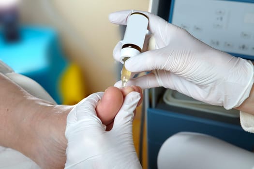 Medical Foot Care - Foot care - Chiropody