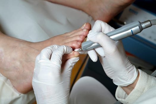 Medical Foot Care - Foot care - Chiropody