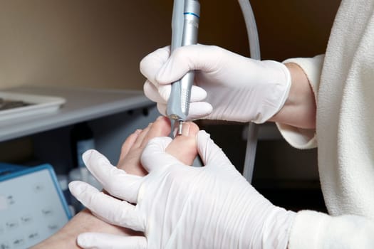 Medical Foot Care - Foot care - Chiropody
