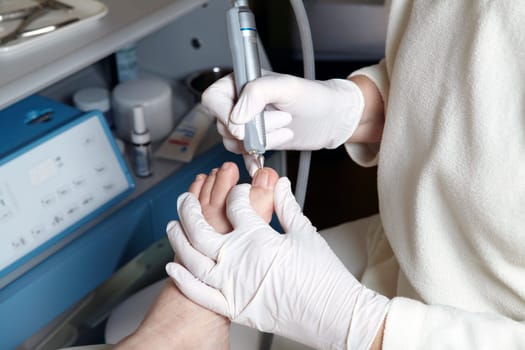 Medical Foot Care - Foot care - Chiropody