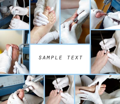 Medical Foot Care - Foot care - Chiropody - Collage
