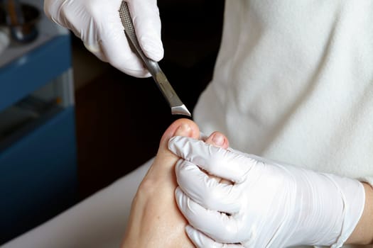 Medical Foot Care - Foot care - Chiropody
