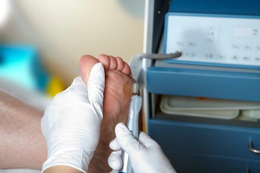Medical Foot Care - Foot care - Chiropody