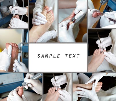 Medical Foot Care - Foot care - Chiropody - Collage