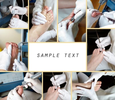 Medical Foot Care - Foot care - Chiropody - Collage