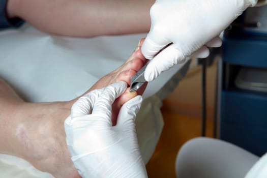 Medical Foot Care - Foot care - Chiropody