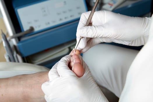 Medical Foot Care - Foot care - Chiropody
