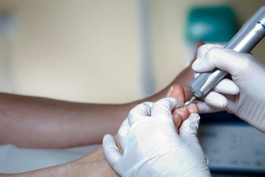Medical Foot Care - Foot care - Chiropody