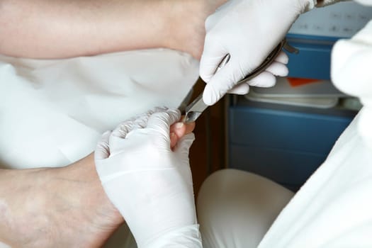 Medical Foot Care - Foot care - Chiropody