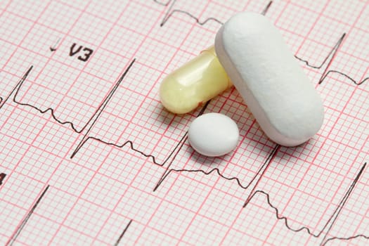 electrocardiogram