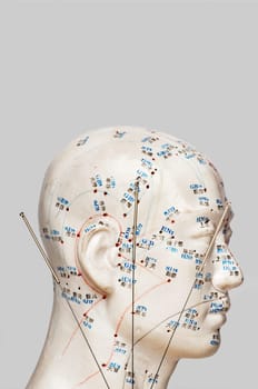 Acupuncture needles