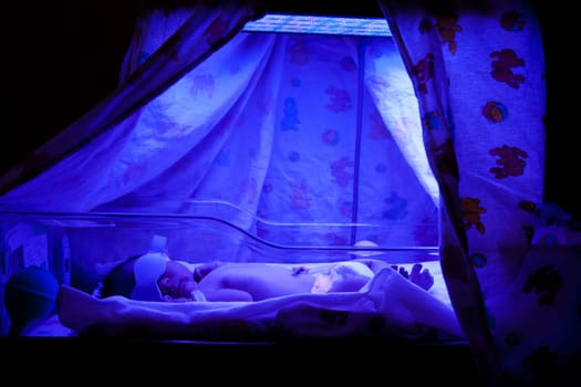 Newborn baby with neonatal jaundice and high bilirubin hyperbilirubinemia under blue UV light for phototheraphy.