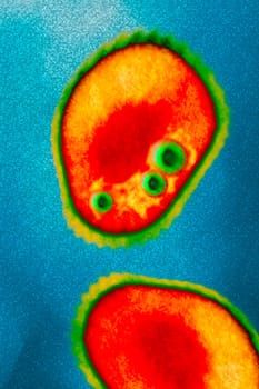 illustrated virus in a cell. Novovirus or other.