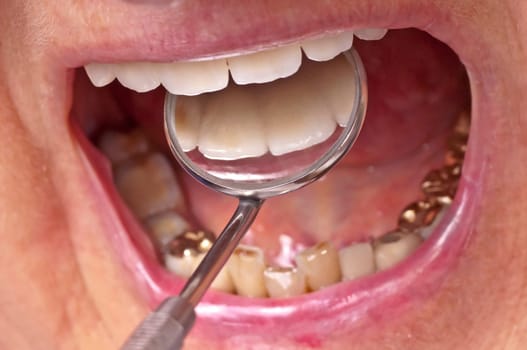 Dental examination