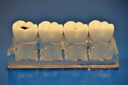 Dental models against blue background