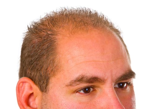 Young man with thinning hair isolated on white background