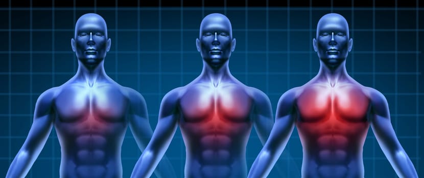Heart illness getting gradualy worse represented by three humans with growing coronary disease of  the chest area represented by increasing red highlight of the cardiac medical inflammation.