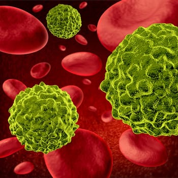 Cancer cells spreading and growing through the body via red blood cells as malignant cells in a human body caused by environmental carcinogens and genetic causes as tumors and cell damage are treated to cure the disease.