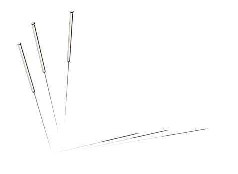 Acupuncture